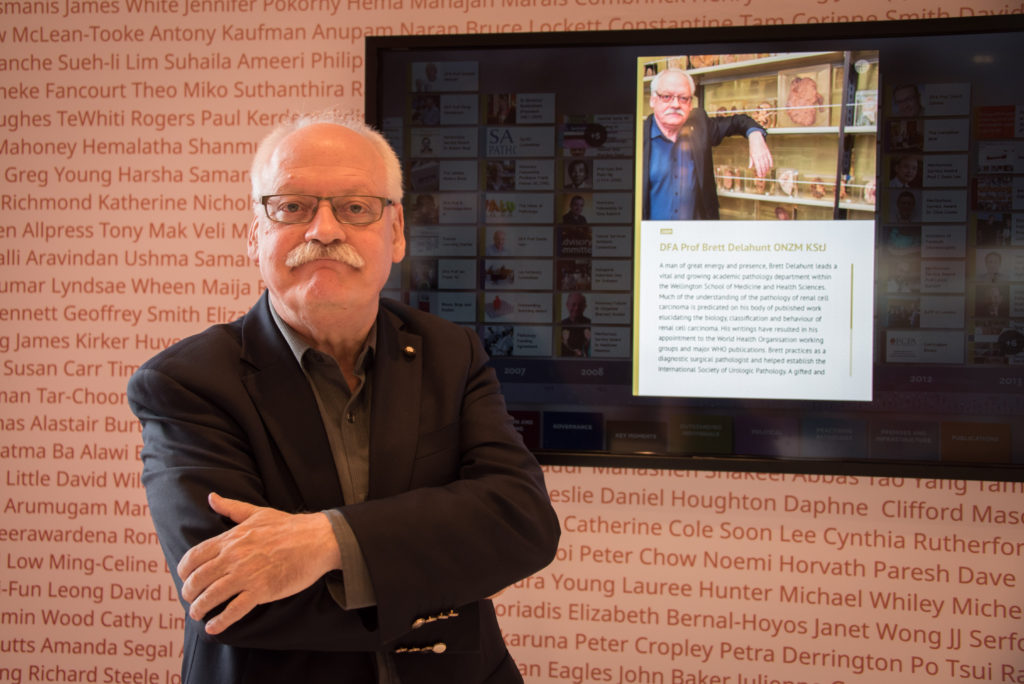 Brett Delahunt posing with his Timeline entry.